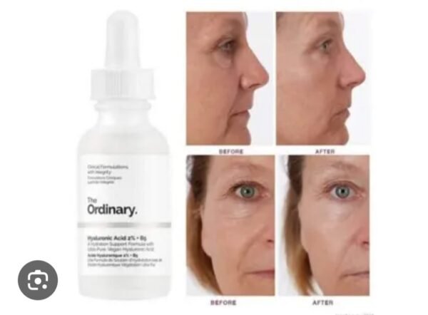 Hyaluronic acid2% /හයලුරොනික් ඇසිඩ් - Image 2
