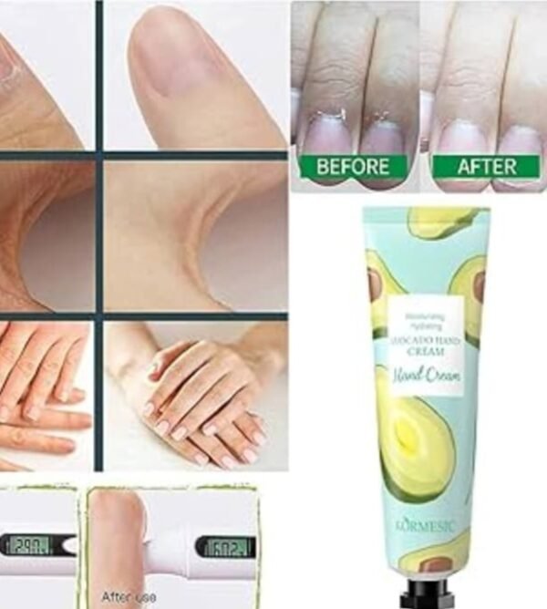 Kormesic Avacado Hand cream/ඇවකාඩෝ හෑන්ඩ් ක්‍රීම් - Image 2